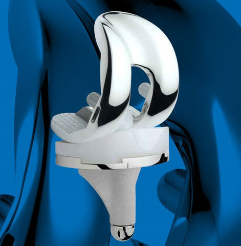 Arthroplasty